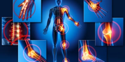 Fibromialgia 